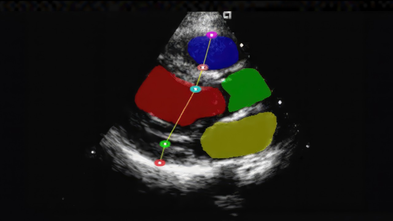 Crea e distribuisci soluzioni nell'ambito dell'imaging medico, dell'elaborazione dei sensori e molto altro ancora.
